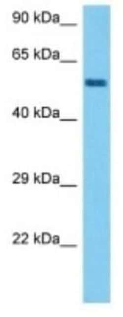FRMD8 Rabbit anti-Mouse, Polyclonal, Novus Biologicals:Antibodies:Primary